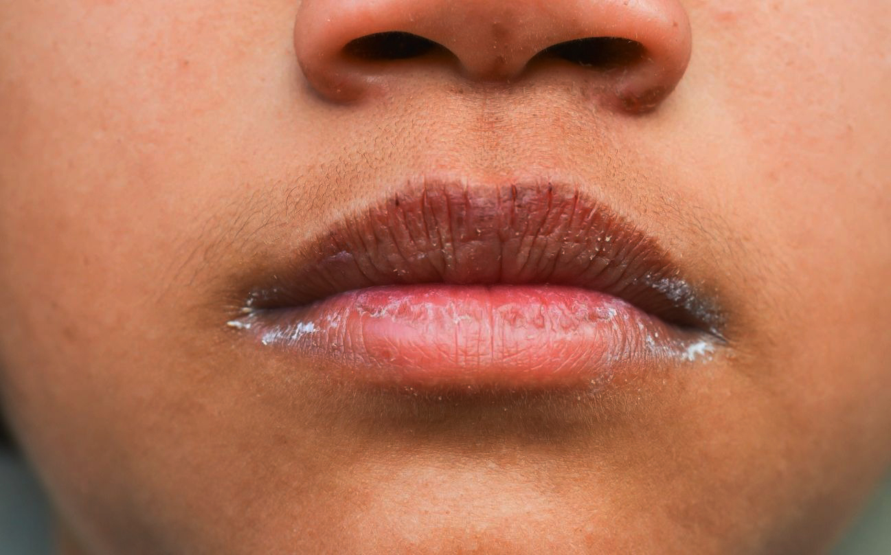 La raison surprenante de votre bouche sèche après avoir savouré des kakis